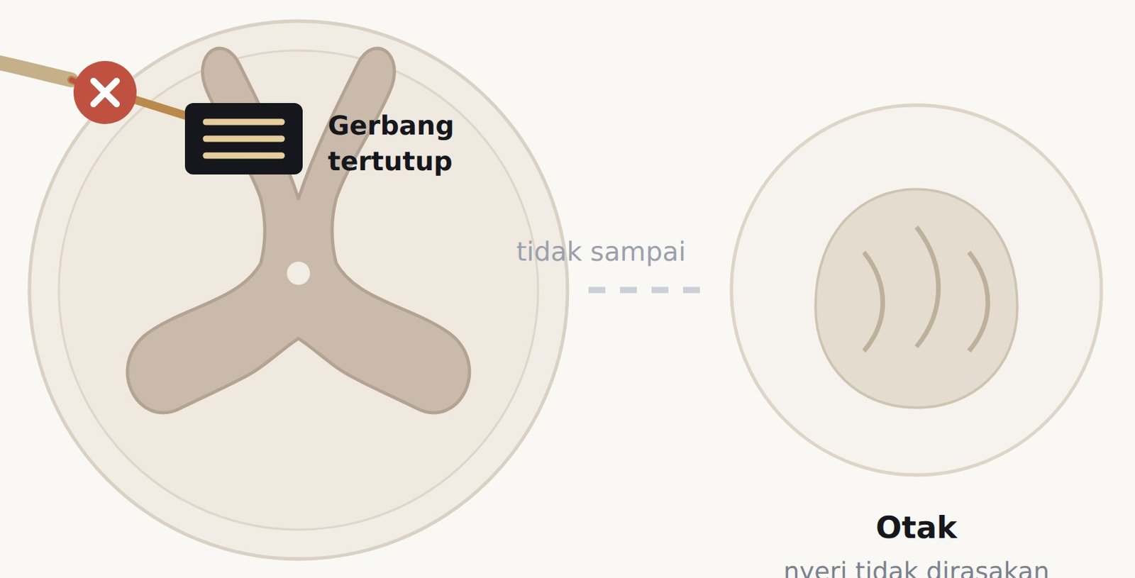 Gerbang tertutup di tanduk dorsal